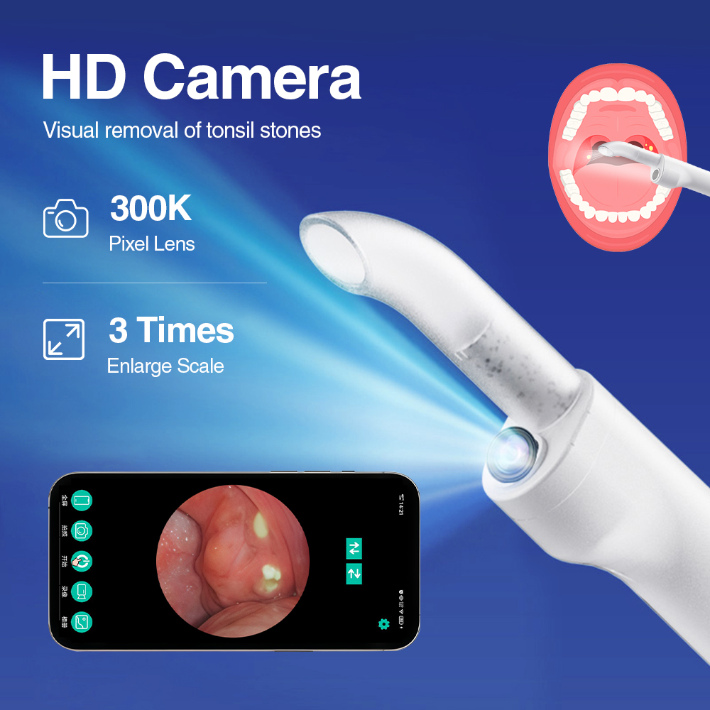 스마트 비주얼 편도 결석 제거 키트 내장형 LED 라이 - Lighting Visual 리뷰 및 가격